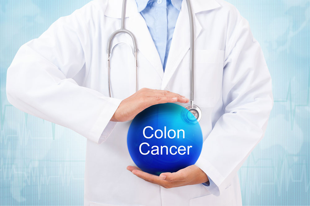 A Comprehensive Guide on Colon Cancer