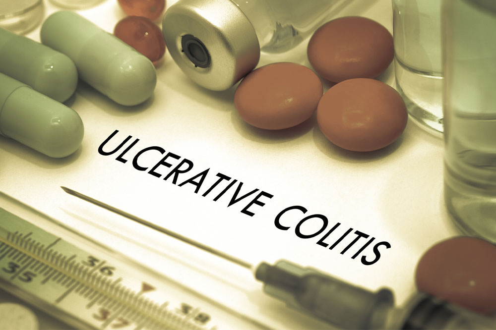 Top 4 Natural Treatments for Ulcerative Colitis