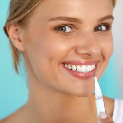Top 5 Whitening Pens for Shining Teeth